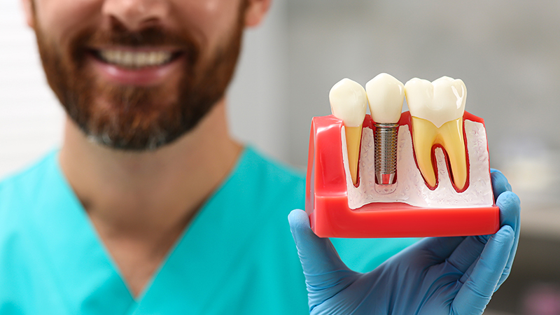 Dental implant dentists serving Cadillac MI